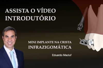 Implante
