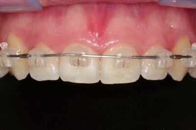 Estética do Sorriso